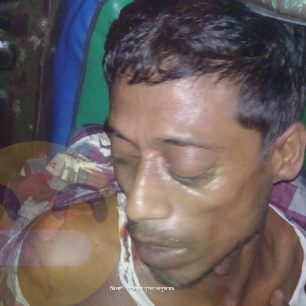 গোবিন্দগঞ্জে সড়ক দু’র্ঘ’টনায় সিএনজি   চালক গু’রু’ত’র আ’হ’ত